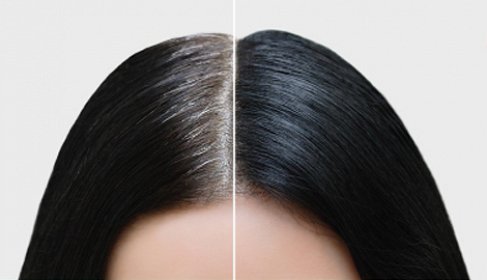 Gray Coverage