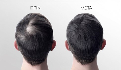 Hair Fibers