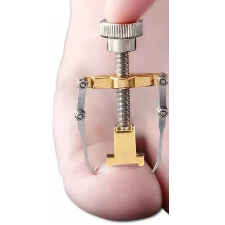 Εργαλείο Επιδιόρθωσης Νυχιού – Εξωλκέας