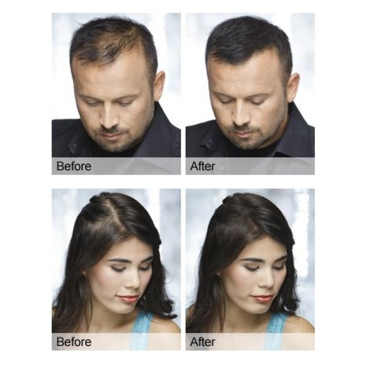 Ίνες Πύκνωσης Μαλλιών Νο 7 Ξανθό Σκούρο 22g