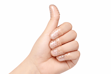 Silicone Toe Protectors 10pcs